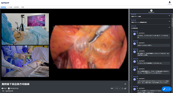 「opeXpark」で見られる手術動画の画面一例